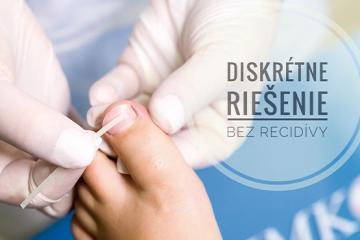 IMKOR centrum, pedikérsko - podologická prax Košice